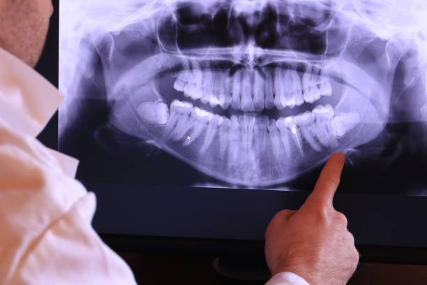 Best Urgent Dental Care for Toothaches in Dequincy, LA